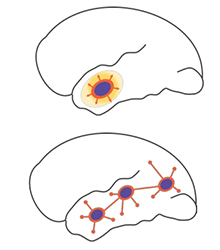From "Role of inhibitory control in modulating focal seizure spread"