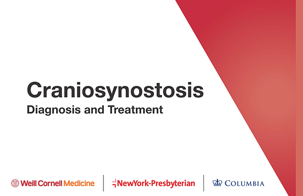 Craniosynostosis: Diagnosis and Treatment