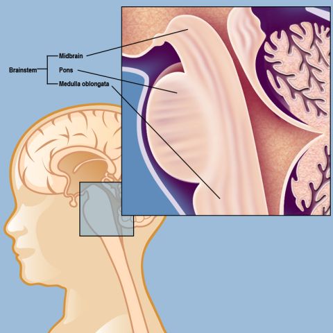 The brainstem consists of three parts: The midbrain, the pons, and the medulla oblongata. DIPG is a 