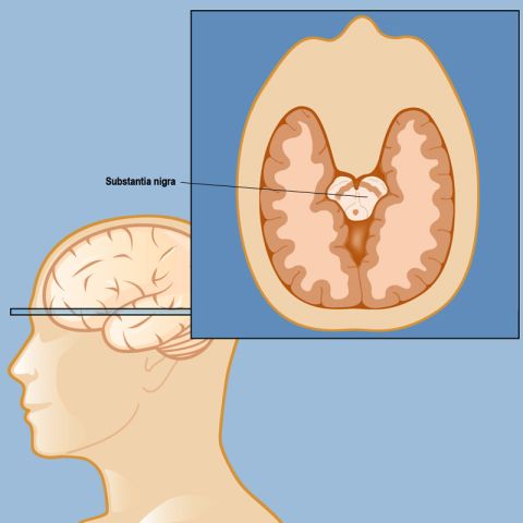 Parkinson's disease and the substantia nigra