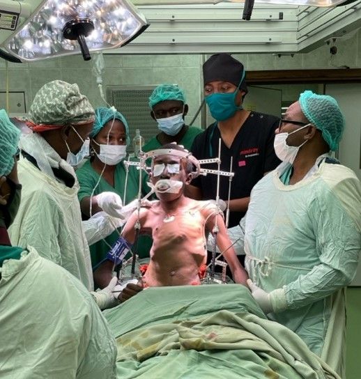 L-R: Dr. Hamisi, Dr. Anastasia (anesthesiologist), Dr. Emerson, Dr. Shabani, and Dr. Mcharo during the application of the halo-pelvic traction device on one young patient.