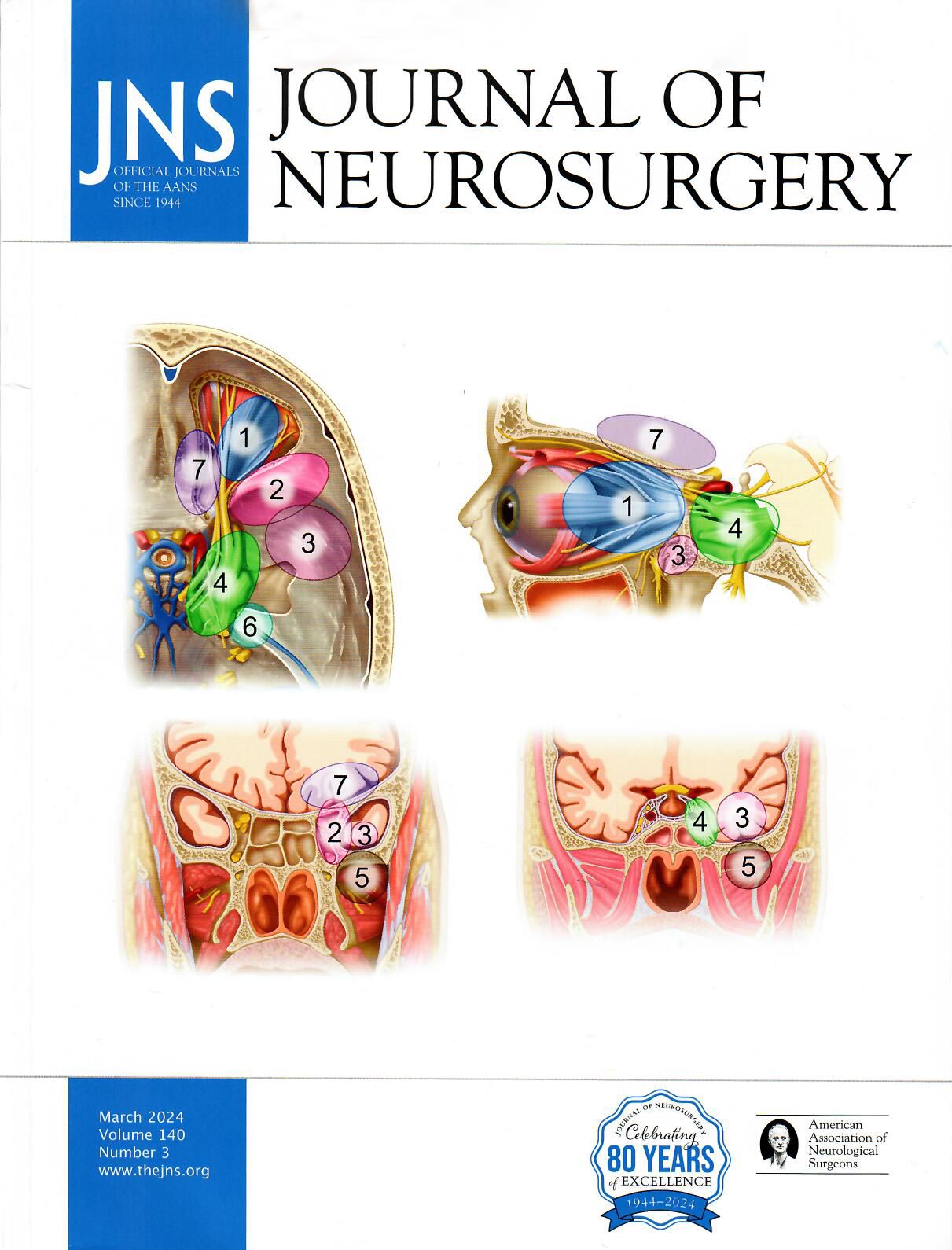 Superior eyelid transorbital approaches: a modular classification system