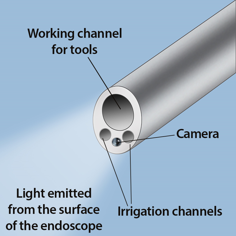 Spinal endoscope