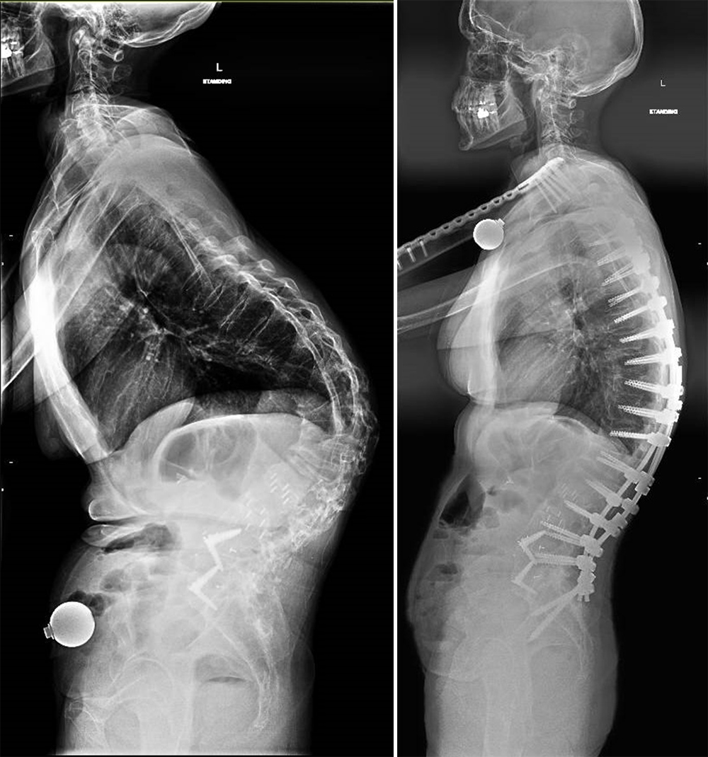 Toni Blankenship's before-and-after MRI scans