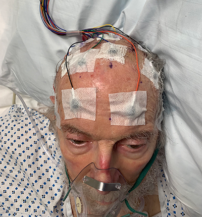 David 'Smoky' Wurzel, shortly after his brain tumor surgery